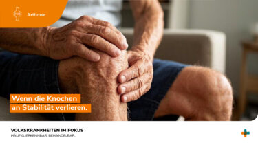 Volkskrankheiten im Fokus: Arthrose